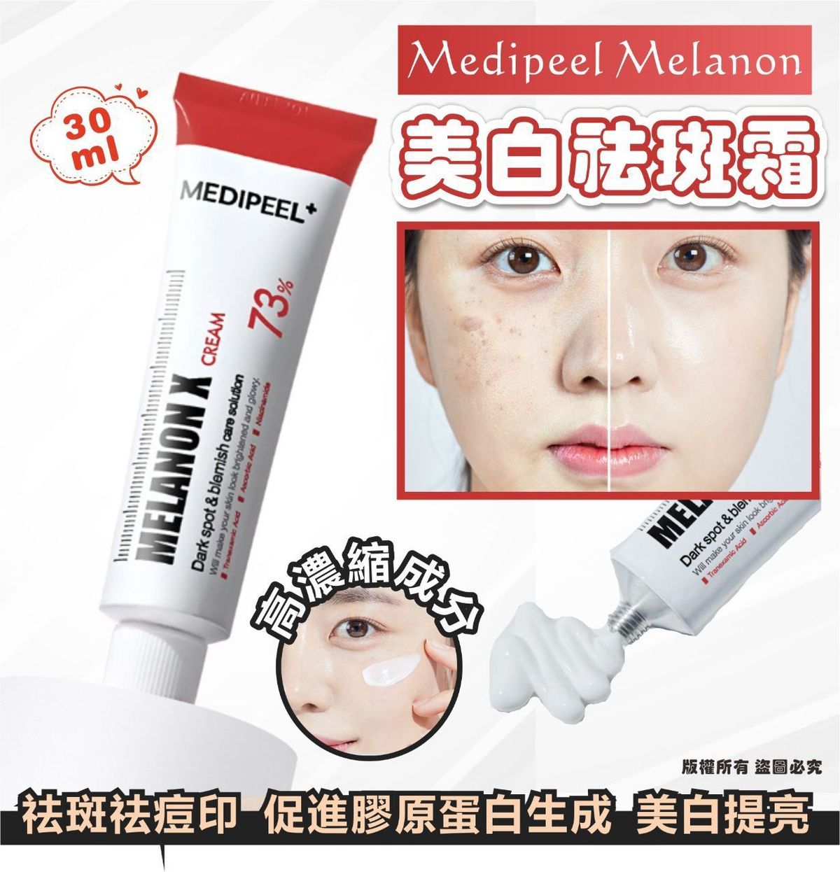 美蒂菲 - MEDIPEEL Melanon 美白祛斑霜 30ml 平行进口